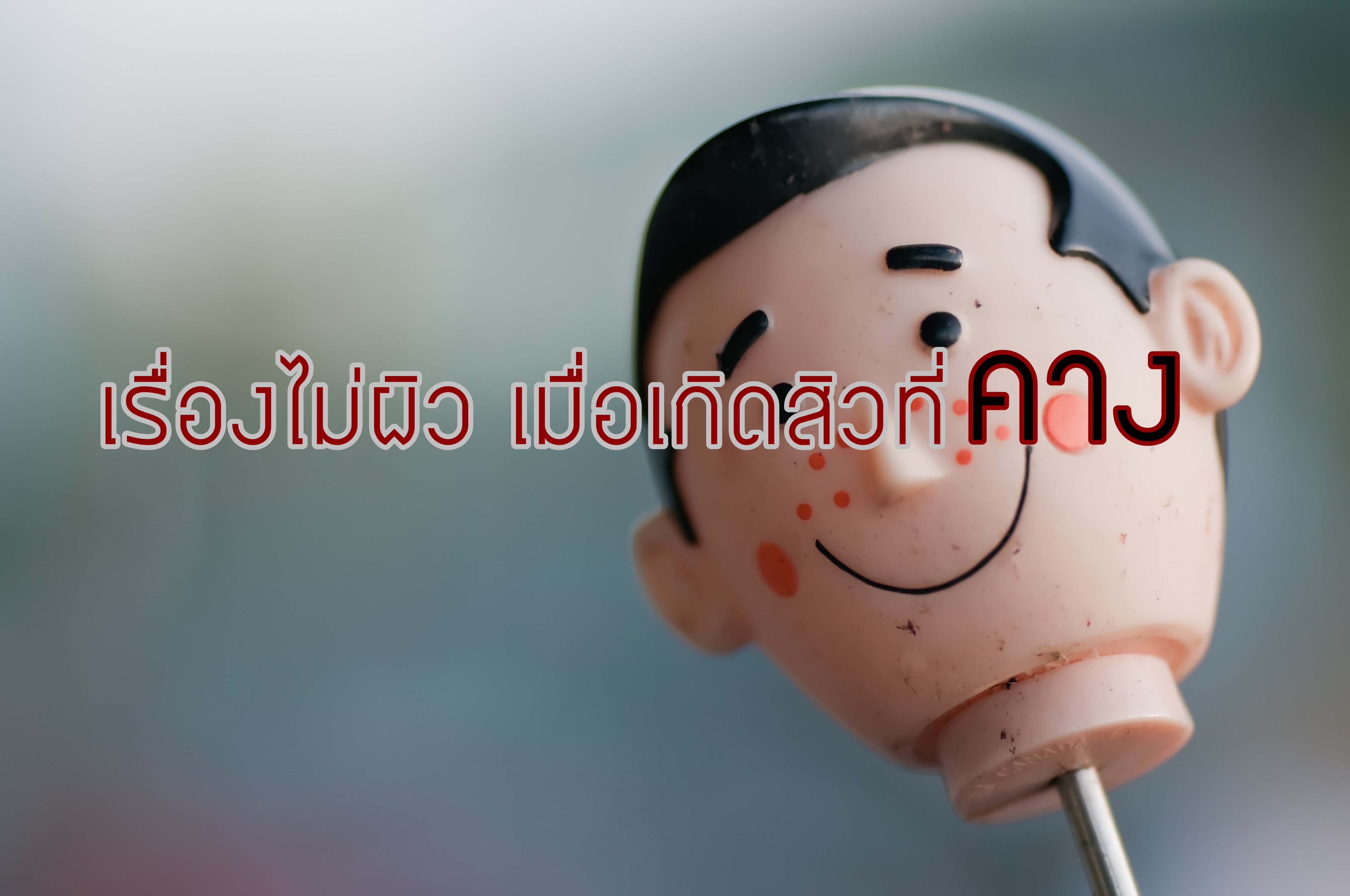 เรื่องไม่ผิว เมื่อเกิดสิวที่คาง